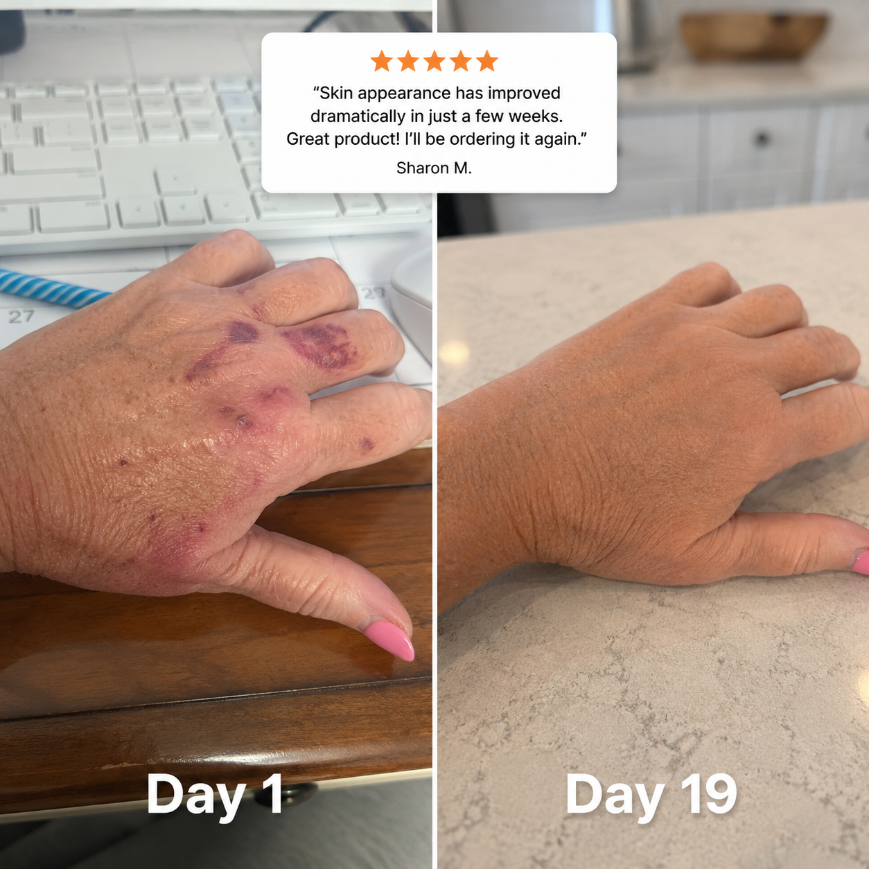 Moisturizing Bruise Formula