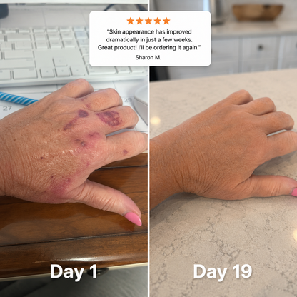 Moisturizing Bruise Formula